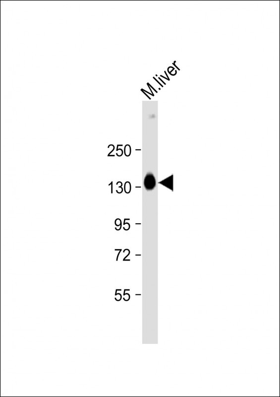 Anti-SASH1 Antibody (Center) at 1:2000 dilution + Mouse liver lysate

Lysates/proteins at 20 µg per lane. 

Secondary
Goat Anti-Rabbit IgG,  (H+L), Peroxidase conjugated at 1/10000 dilution. 

Predicted band size : 137 kDa

Blocking/Dilution buffer: 5% NFDM/TBST.