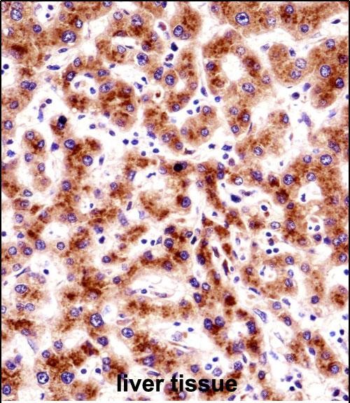 SEC61B Antibody (Center) (AP53833PU-N)immunohistochemistry analysis in formalin fixed and paraffin embedded human liver tissue followed by peroxidase conjugation of the secondary antibody and DAB staining.This data demonstrates the use of SEC61B Antibody (Center) for immunohistochemistry.  Clinical relevance has not been evaluated.