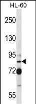 SECISBP2 Antibody (Center) (Cat. #AP53835PU-N) western blot analysis in HL-60 cell line lysates (35ug/lane).This demonstrates the SECISBP2 antibody detected the SECISBP2 protein (arrow).