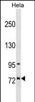 SF4 Antibody (Center) (Cat. #AP53872PU-N) western blot analysis in Hela cell line lysates (35ug/lane).This demonstrates the SF4 antibody detected the SF4 protein (arrow).