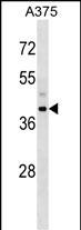 SNUPN Antibody (Center) (Cat. #AP53970PU-N) western blot analysis in A375 cell line lysates (35ug/lane).This demonstrates the SNUPN antibody detected the SNUPN protein (arrow).