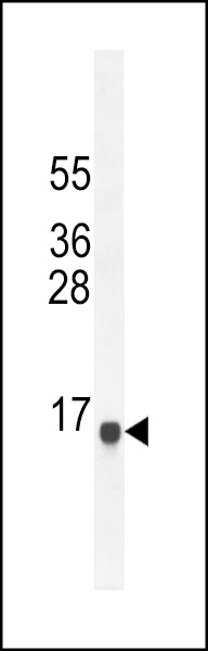 SPAG11A Antibody (N-term) (Cat. #AP53998PU-N) western blot analysis in NCI-H292 cell line lysates (35ug/lane).This demonstrates the SPAG11A antibody detected the SPAG11A protein (arrow).