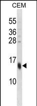 SPRR3 Antibody (C-term) (Cat. #AP54035PU-N) western blot analysis in CEM cell line lysates (35ug/lane).This demonstrates the SPRR3 antibody detected the SPRR3 protein (arrow).