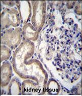 STIM2 Antibody (N-term) (Cat. #AP54073PU-N)immunohistochemistry analysis in formalin fixed and paraffin embedded human kidney tissue followed by peroxidase conjugation of the secondary antibody and DAB staining.This data demonstrates the use of STIM2 Antibody (N-term) for immunohistochemistry.  Clinical relevance has not been evaluated.
