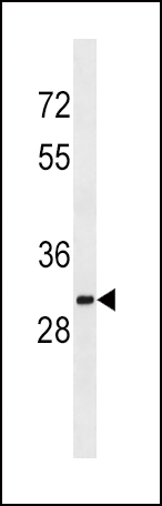 SULT1A2 Antibody (C-term) (Cat. #AP54100PU-N) western blot analysis in K562 cell line lysates (35ug/lane).This demonstrates the SULT1A2 antibody detected the SULT1A2 protein (arrow).