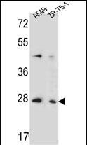 T4S4 Antibody (N-term) (Cat. #AP54133PU-N) western blot analysis in A549,ZR-75-1 cell line lysates (35ug/lane).This demonstrates the T4S4 antibody detected the T4S4 protein (arrow).