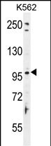 TAS1R2 Antibody (C-term) (Cat. #AP54154PU-N) western blot analysis in K562 cell line lysates (35ug/lane).This demonstrates the TAS1R2 antibody detected the TAS1R2 protein (arrow).