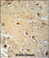 TBC14 antibody (Center) (Cat. #AP54164PU-N) immunohistochemistry analysis in formalin fixed and paraffin embedded human brain tissie followed by peroxidase conjugation of the secondary antibody and DAB staining.  This data demonstrates the use of the TBC14 antibody (Center) for immunohistochemistry.  Clinical relevance has not been evaluated.