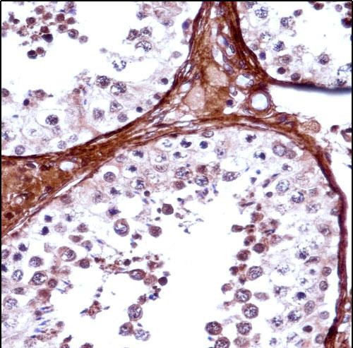 TBX5 Antibody (N-term) (AP14687a)immunohistochemistry analysis in formalin fixed and paraffin embedded human testis tissue followed by peroxidase conjugation of the secondary antibody and DAB staining.This data demonstrates the use of TBX5 Antibody (N-term) for immunohistochemistry.  Clinical relevance has not been evaluated.