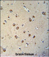 TECTB antibody (N-term) (Cat. #AP10280a) immunohistochemistry analysis in formalin fixed and paraffin embedded human brain tissue followed by peroxidase conjugation of the secondary antibody and DAB staining.  This data demonstrates the use of the TECTB antibody (N-term) for immunohistochemistry.  Clinical relevance has not been evaluated.
