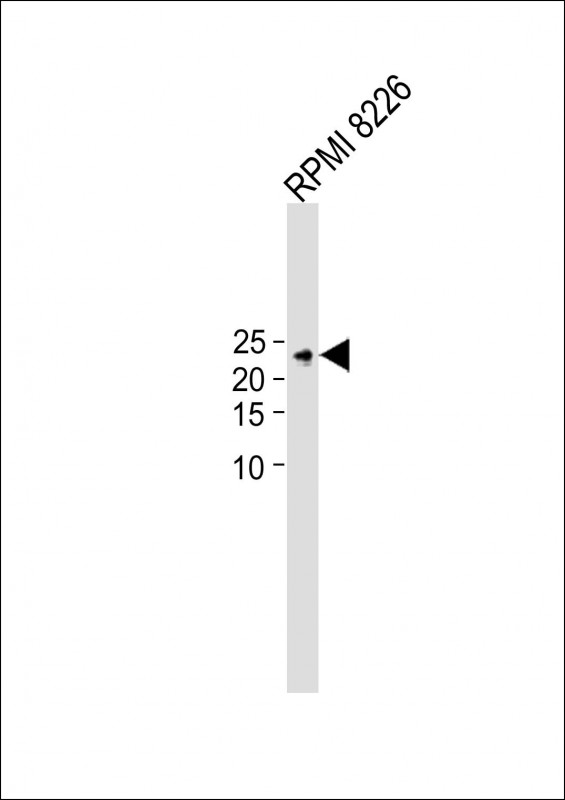 All lanes : Anti-TIFA Antibody (N-term) at 1:2000 dilution+ RPMI 8226 whole cell lysate

Lysates/proteins at 20 µg per lane. 

Secondary Goat Anti-Rabbit IgG,  (H+L), Peroxidase conjugated (ASP1615)  at 1/15000 dilution. 

Observed band size : 21kDa

Blocking/Dilution buffer: 5% NFDM/TBST.