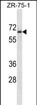 TM117 Antibody (C-term) (Cat. #AP54273PU-N) western blot analysis in ZR-75-1 cell line lysates (35ug/lane).This demonstrates the TM117 antibody detected the TM117 protein (arrow).