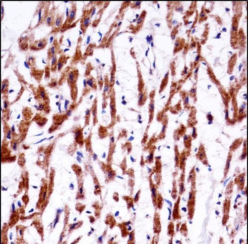 TMM85 Antibody (N-term) (AP54293PU-N)immunohistochemistry analysis in formalin fixed and paraffin embedded human heart tissue followed by peroxidase conjugation of the secondary antibody and DAB staining.This data demonstrates the use of TMM85 Antibody (N-term) for immunohistochemistry.  Clinical relevance has not been evaluated.