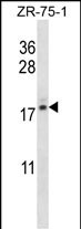 TNP2 Antibody (C-term) (Cat. #AP54325PU-N) western blot analysis in ZR-75-1 cell line lysates (35ug/lane).This demonstrates the TNP2 antibody detected the TNP2 protein (arrow).