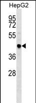 TRAF4 Antibody (C-term) (Cat. #AP54351PU-N) western blot analysis in HepG2 cell line lysates (35ug/lane).This demonstrates the TRAF4 antibody detected the TRAF4 protein (arrow).