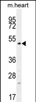 TSPYL4 Antibody (C-term) (Cat. #AP54386PU-N) western blot analysis in mouse heart tissue lysates (35ug/lane).This demonstrates the TSPYL4 antibody detected the TSPYL4 protein (arrow).