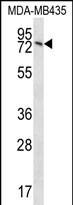 UNC84B Antibody (Center) (Cat. #AP54462PU-N) western blot analysis in MDA-MB435 cell line lysates (35ug/lane).This demonstrates the UNC84B antibody detected the UNC84B protein (arrow).