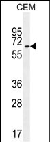 UNCX Antibody (C-term) (Cat. #AP54463PU-N) western blot analysis in CEM cell line lysates (35ug/lane).This demonstrates the UNCX antibody detected the UNCX protein (arrow).