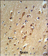 URG4 Antibody (Center) (Cat. #AP54482PU-N) IHC analysis in formalin fixed and paraffin embedded brain tissue followed by peroxidase conjugation of the secondary antibody and DAB staining.  This data demonstrates the use of the URG4 Antibody (Center) for immunohistochemistry.  Clinical relevance has not been evaluated.