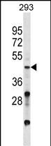 VSX2 Antibody (C-term) (Cat. #AP54526PU-N) western blot analysis in 293 cell line lysates (35ug/lane).This demonstrates the VSX2 antibody detected the VSX2 protein (arrow).