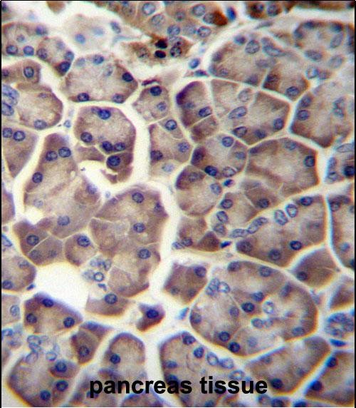 WDR12 Antibody (Center) (Cat. #AP54534PU-N)immunohistochemistry analysis in formalin fixed and paraffin embedded human pancreas tissue followed by peroxidase conjugation of the secondary antibody and DAB staining.This data demonstrates the use of WDR12 Antibody (Center) for immunohistochemistry.  Clinical relevance has not been evaluated.