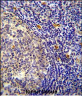 YDJC Antibody (Center) (Cat. #AP54593PU-N) immunohistochemistry analysis in formalin fixed and paraffin embedded human tonsil tissue followed by peroxidase conjugation of the secondary antibody and DAB staining.  This data demonstrates the use of the YDJC Antibody (Center) for immunohistochemistry.  Clinical relevance has not been evaluated.