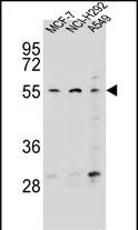 ZNF117 Antibody (N-term) (Cat. #AP54668PU-N) western blot analysis in MCF-7,NCI-H292,A549 cell line lysates (35ug/lane).This demonstrates the ZNF117 antibody detected the ZNF117 protein (arrow).