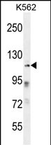 ZNF99 Antibody (N-term) (Cat. #AP54735PU-N) western blot analysis in K562 cell line lysates (35ug/lane).This demonstrates the ZNF99 antibody detected the ZNF99 protein (arrow).
