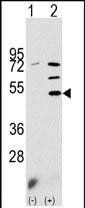 Western blot analysis of PDK3 (arrow) using rabbit polyclonal PDK3 Antibody (N-term) (Cat# TA302064). 293 cell lysates (2 ug/lane) either nontransfected (Lane 1) or transiently transfected with the PDK3 gene (Lane 2) (Origene Technologies).