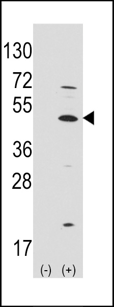 Western blot analysis of ATOH1 (arrow) using rabbit polyclonal ATOH1 Antibody (C-term) (Cat.#AP2702b).293 cell lysates (2 ug/lane) either nontransfected (Lane 1) or transiently transfected with the ATOH1 gene (Lane 2) (Origene Technologies).