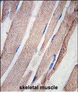 Formalin-fixed and paraffin-embedded human skeletal muscle tissue reacted with PHPT1 Antibody (C-term), which was peroxidase-conjugated to the secondary antibody, followed by DAB staining. This data demonstrates the use of this antibody for immunohistochemistry; clinical relevance has not been evaluated.