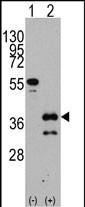 Western blot analysis of ZIC4 (arrow) using rabbit polyclonal ZIC4 Antibody (C-term) (Cat.#TA302374).
293 cell lysates (2 ug/lane) either nontransfected (Lane 1) or transiently transfected with the ZIC4 gene (Lane 2) (Origene Technologies).