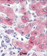 Formalin-fixed and paraffin-embedded human Liver tissue reacted with SYVN1 (HRD1) Antibody (C-term)(Cat.#AP2184a), which was peroxidase-conjugated to the secondary antibody, followed by AEC staining. This data demonstrates the use of this antibody for immunohistochemistry; clinical relevance has not been evaluated.