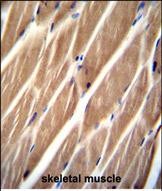 PIP5KL1 Antibody (N-term) (Cat. #TA324394)immunohistochemistry analysis in formalin fixed and paraffin embedded human skeletal muscle followed by peroxidase conjugation of the secondary antibody and DAB staining.This data demonstrates the use of PIP5KL1 Antibody (N-term) for immunohistochemistry.  Clinical relevance has not been evaluated.