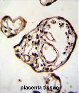 PM20D2 Antibody (C-term) (Cat. #TA324403)immunohistochemistry analysis in formalin fixed and paraffin embedded human placenta tissue followed by peroxidase conjugation of the secondary antibody and DAB staining.This data demonstrates the use of PM20D2 Antibody (C-term) for immunohistochemistry.  Clinical relevance has not been evaluated.
