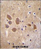 AP1M1 Antibody (Center) (Cat. #TA324464)immunohistochemistry analysis in formalin fixed and paraffin embedded human brain tissue followed by peroxidase conjugation of the secondary antibody and DAB staining.This data demonstrates the use of AP1M1 Antibody (Center) for immunohistochemistry.  Clinical relevance has not been evaluated.