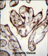 PYGO1 Antibody (C-term) (Cat. #TA324480)immunohistochemistry analysis in formalin fixed and paraffin embedded human placenta tissue followed by peroxidase conjugation of the secondary antibody and DAB staining.This data demonstrates the use of PYGO1 Antibody (C-term) for immunohistochemistry.  Clinical relevance has not been evaluated.