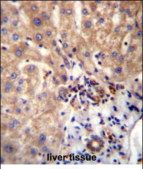 DVL1 Antibdy (Center) (Cat. #AP12326c)immunohistochemistry analysis in formalin fixed and paraffin embedded human liver tissue followed by peroxidase conjugation of the secondary antibody and DAB staining.This data demonstrates the use of DVL1 Antibdy (Center) for immunohistochemistry.  Clinical relevance has not been evaluated.