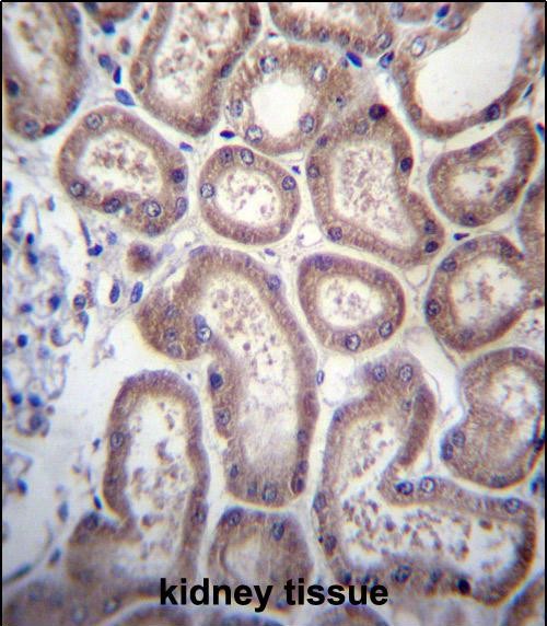 SP140 Antibody (Center) (Cat. #AP12872c)immunohistochemistry analysis in formalin fixed and paraffin embedded human kidney tissue followed by peroxidase conjugation of the secondary antibody and DAB staining.This data demonstrates the use of SP140 Antibody (Center) for immunohistochemistry.  Clinical relevance has not been evaluated.