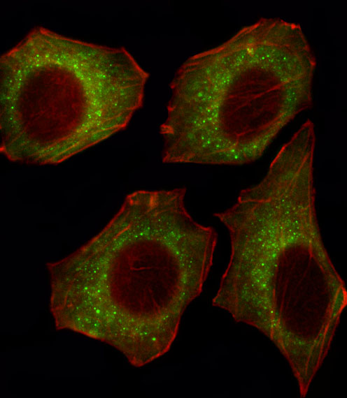 Fluorescent image of U251 cell stained with CACNA2D2 Antibody (Center)(Cat#AP13380c).U251 cells were fixed with 4% PFA (20 min), permeabilized with Triton X-100 (0.1%, 10 min), then incubated with CACNA2D2 primary antibody (1:25, 1 h at 37℃). For secondary antibody, Alexa Fluor® 488 conjugated donkey anti-rabbit antibody (green) was used (1:400, 50 min at 37℃).Cytoplasmic actin was counterstained with Alexa Fluor® 555 (red) conjugated Phalloidin (7units/ml, 1 h at 37℃).CACNA2D2 immunoreactivity is localized to Cytoplasm significantly.
