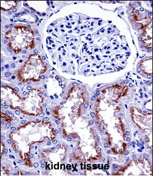 NOX4 Antibody (N-term) (AP14025a)immunohistochemistry analysis in formalin fixed and paraffin embedded human kidney tissue followed by peroxidase conjugation of the secondary antibody and DAB staining.This data demonstrates the use of NOX4 Antibody (N-term) for immunohistochemistry.  Clinical relevance has not been evaluated.
