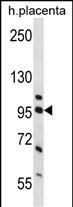 NCL Antibody (Center P291) (Cat. #AP14641c) western blot analysis in human placenta tissue lysates (35ug/lane).This demonstrates the NCL antibody detected the NCL protein (arrow).