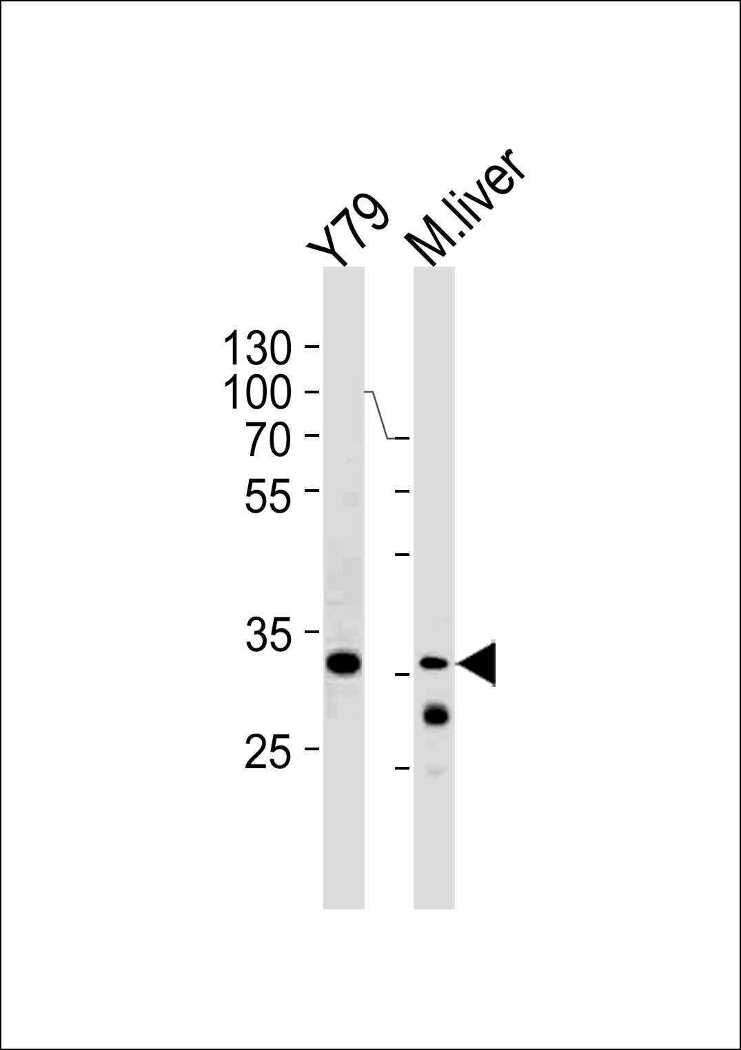 CSDA Antibody (Center) (Cat.# TA324558) western blot analysis in Y79 cell line and mouse liver lysates (35ug/lane).This demonstrates the CSDA antibody detected the CSDA protein (arrow).