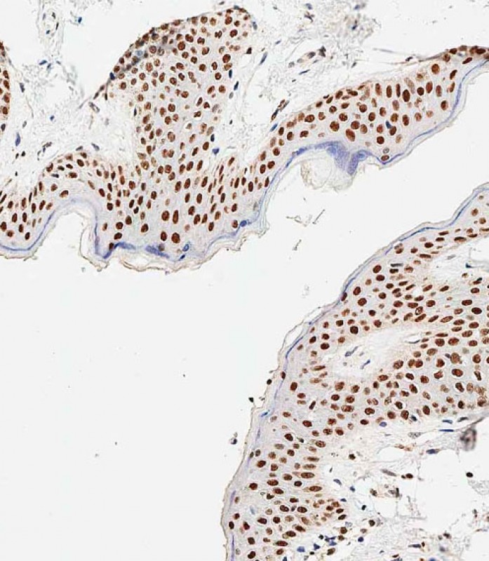 Immunohistochemical analysis of paraffin-embedded human skin tissue using TA324567 performed on the Leica® BOND RXm. Tissue was fixed with formaldehyde at room temperature,  antigen retrieval was by heat mediation with a EDTA buffer (pH9. 0). Samples were incubated with primary antibody(1:500) for 1 hours at room temperature.  A undiluted biotinylated CRF Anti-Polyvalent HRP Polymer antibody was used as the secondary antibody.