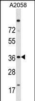 ISL2 Antibody (N-term) (Cat. #TA324600) western blot analysis in A2058 cell line lysates (35ug/lane).This demonstrates the ISL2 antibody detected the ISL2 protein (arrow).