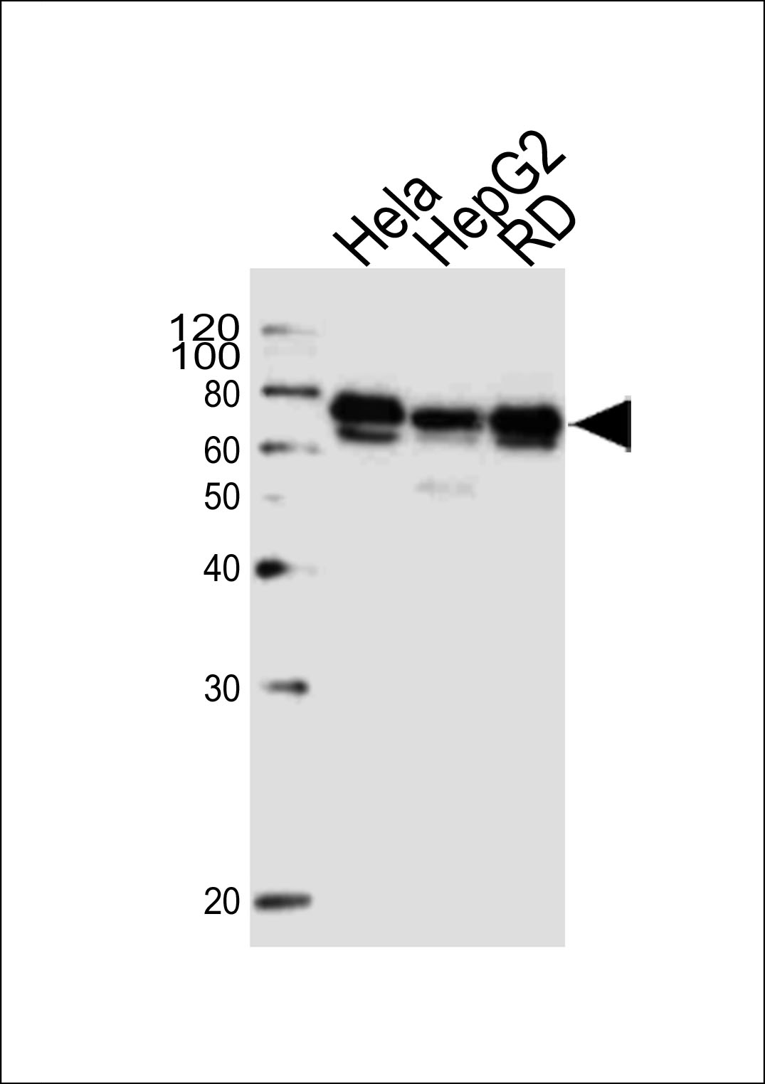 Western blot analysis of lysates from Hela, HepG2, RD cell line (from left to right),  using PRKAG3 Antibody (C-term)(Cat.  #TA324610).  TA324610 was diluted at 1:1000 at each lane.  A goat anti-rabbit IgG H&L(HRP) at 1:10000 dilution was used as the secondary antibody. Lysates at 20ug per lane.