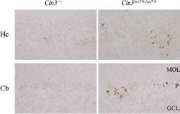 Wild-type (Cln3+/+) or homozygous Cln3Äex7/8 (Cln3Äex7/8/Äex7/8) paraffin-embedded brain sections immunostained for the LC3 protein (Cat. # TA324625 LC3 antibody). Shown are the CA2/CA3 region of hippocampus (Hc) and cerebellum (Cb) from 10-month-old mice. Few immunopositive puncta are present in wild-type sections, whereas homozygous Cln3Äex7/8 sections contain clusters of LC3-positive puncta around pyramidal neurons and Purkinje cells (P). MOL, molecular layer; GCL, granule cell layer. Data courtesy of Dr. Susan Cotman, Massachusets General Hospital.