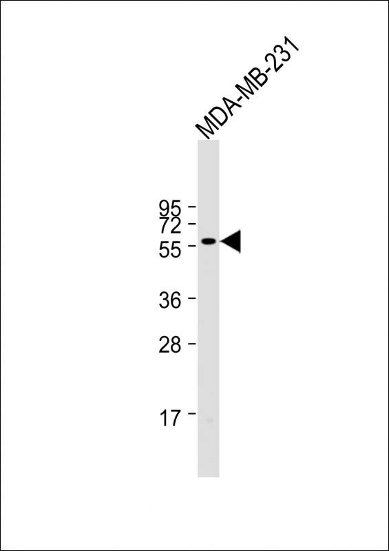Anti-ONECUT3 Antibody (C-term) at 1:1000 dilution + MDA-MB-231 whole cell lysate

Lysates/proteins at 20 µg per lane.  

Secondary
Goat Anti-Rabbit IgG,   (H+L),  Peroxidase conjugated at 1/10000 dilution.  

Predicted band size : 50 kDa

Blocking/Dilution buffer: 5% NFDM/TBST.