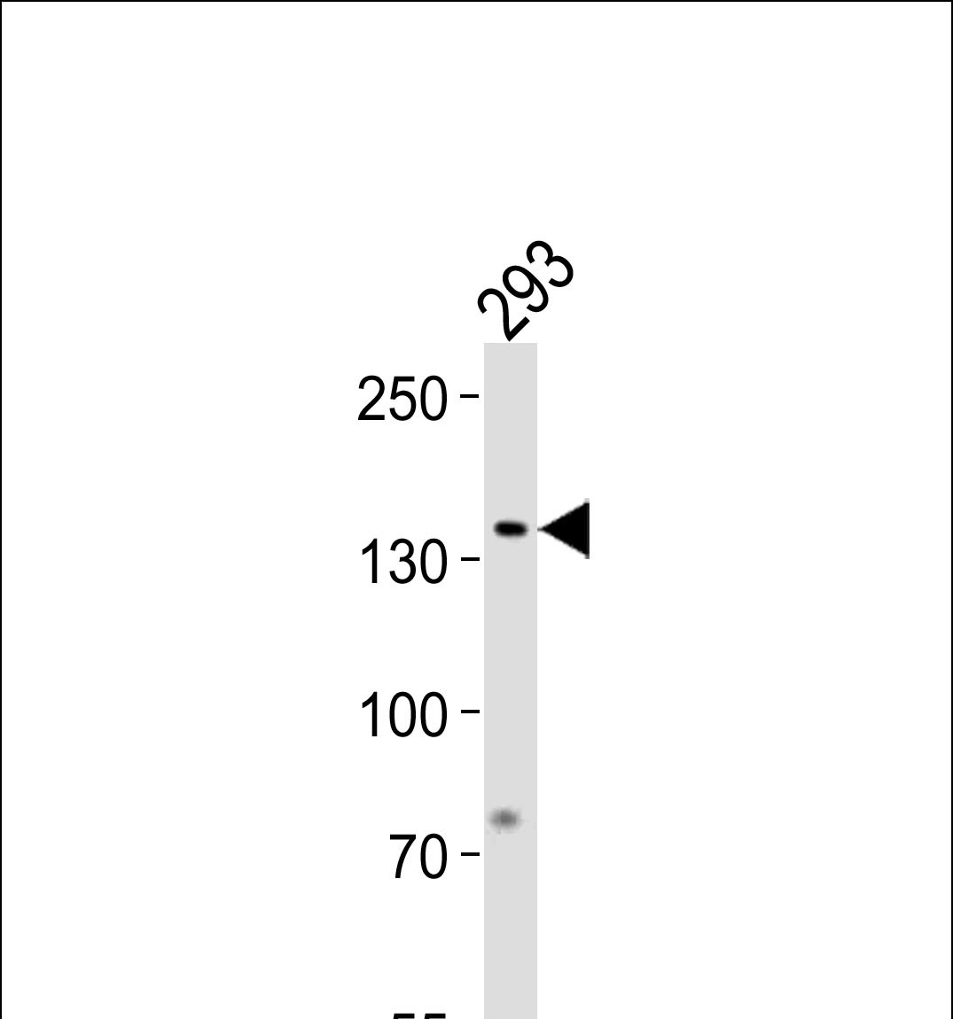 GTF2I Antibody (N-term) (Cat. #TA324632) western blot analysis in 293 cell line lysates (35ug/lane).This demonstrates the GTF2I antibody detected the GTF2I protein (arrow).