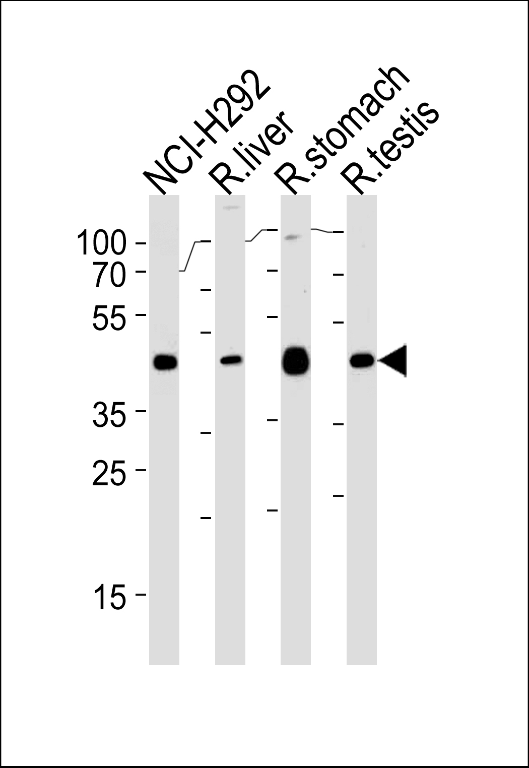 PCGF6 Antibody (Center) (Cat.# TA324658) western blot analysis in NCI-H292,rat liver,stomach and testis cell line lysates (35ug/lane).This demonstrates the PCGF6 antibody detected the PCGF6 protein (arrow).